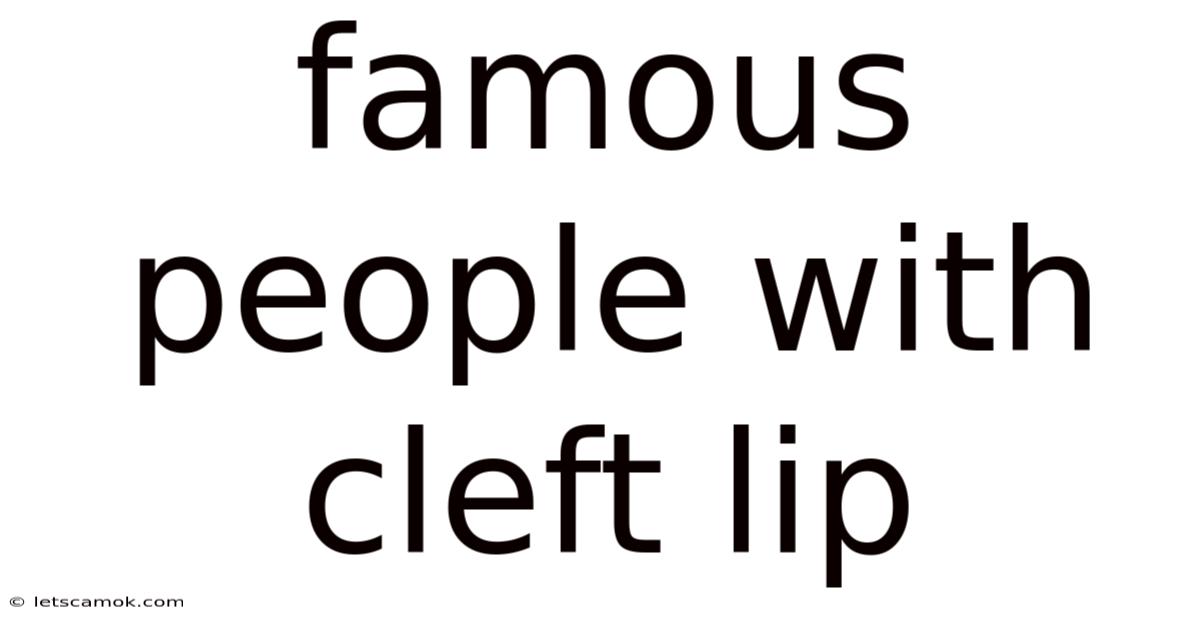 Famous People With Cleft Lip