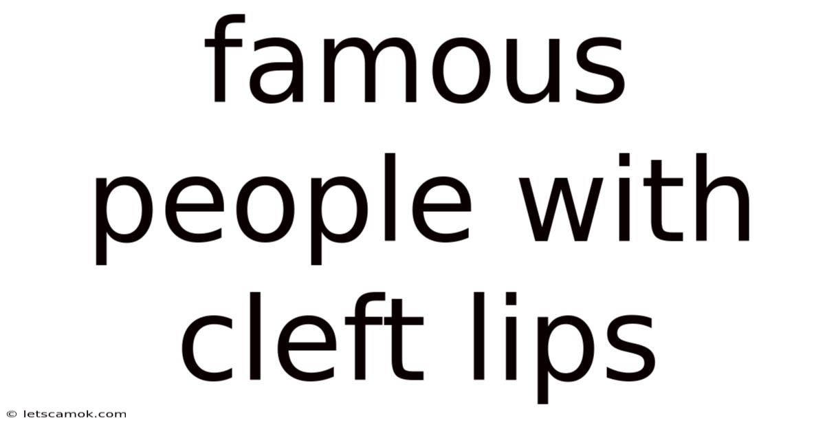 Famous People With Cleft Lips