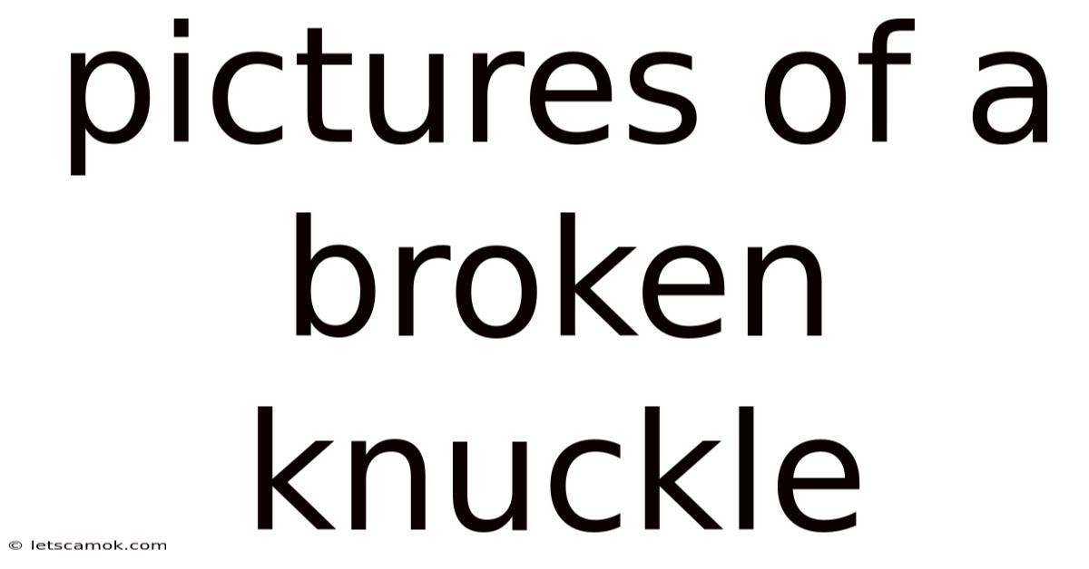 Pictures Of A Broken Knuckle